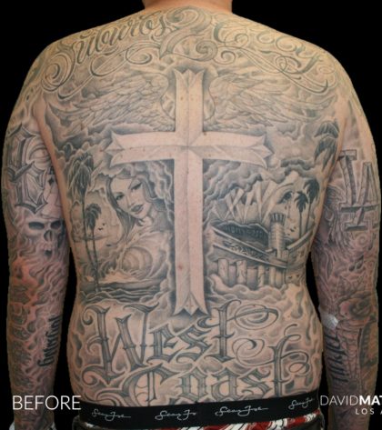High Def Liposuction Male Before & After Patient #2730