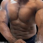 High Def Liposuction Male Before & After Patient #2731